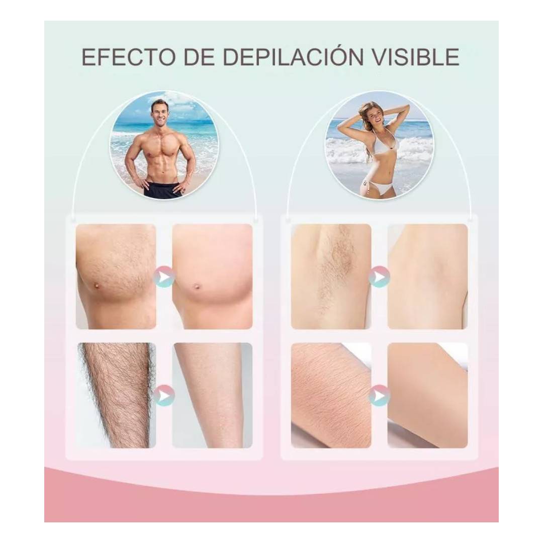 MÁQUINA DEPILADORA LÁSER PERMANENTE - Mi tienda